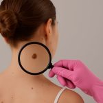 Qué son los chorlitos marinos, el hallazgo antártico que podría ser clave en el tratamiento del melanoma