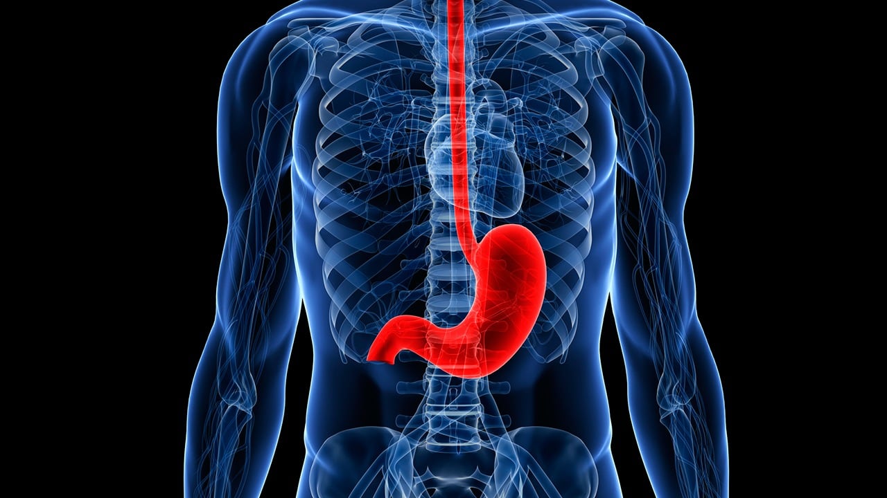 Médicos advierten que la presencia de sangre en el vómito o en la materia fecal, de color granate o negro, es una señal relevante de posible cáncer de estómago