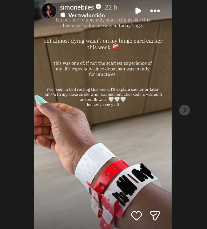 La gimnasta olímpica Simone Biles comparte una imagen de su brazo con pulseras de hospital tras un reciente susto de salud que describió como aterrador. (Instagram: Simone Biles)