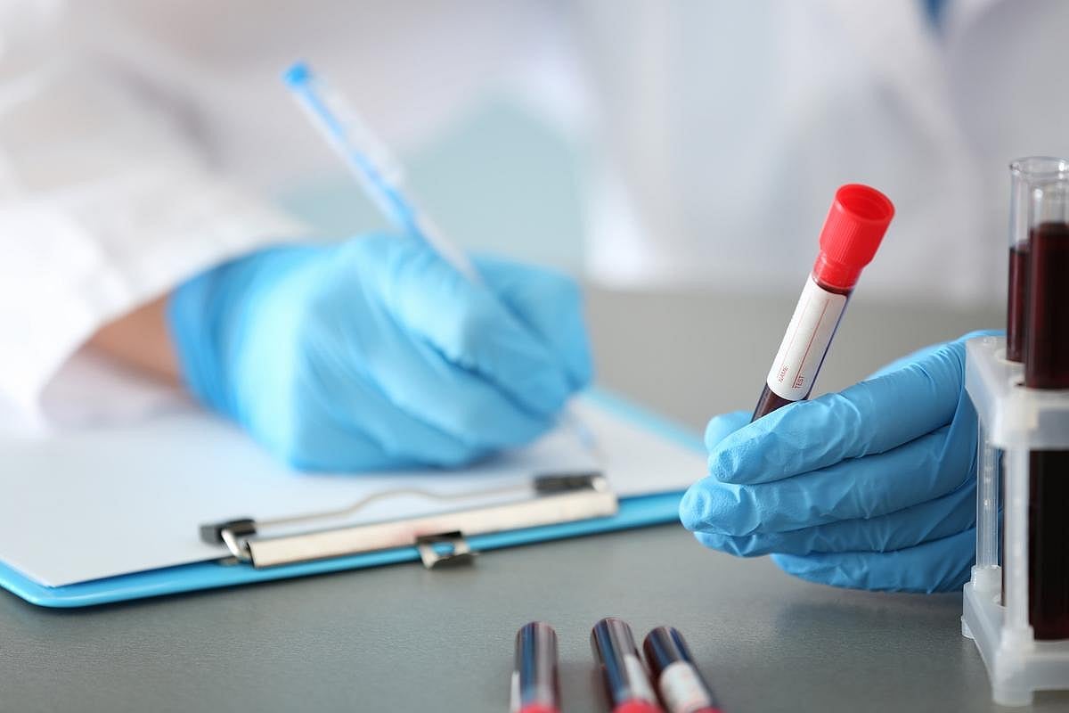 Un simple análisis de sangre puede ayudar a detectar y estadiar la enfermedad de Alzheimer