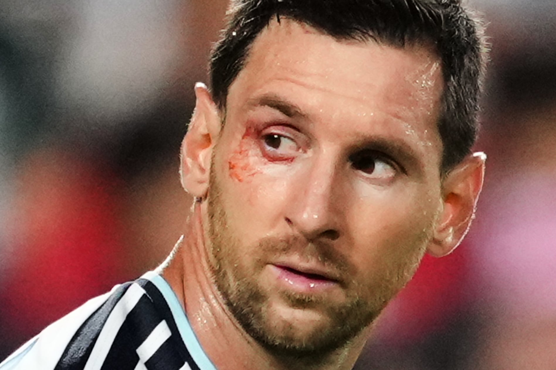 Lionel Messi sufrió un corte en el ojo derecho tras el intenso duelo de cuartos de final ante Suiza. El capitán afirmó que está bien (AP Photo/Ed Zurga)
