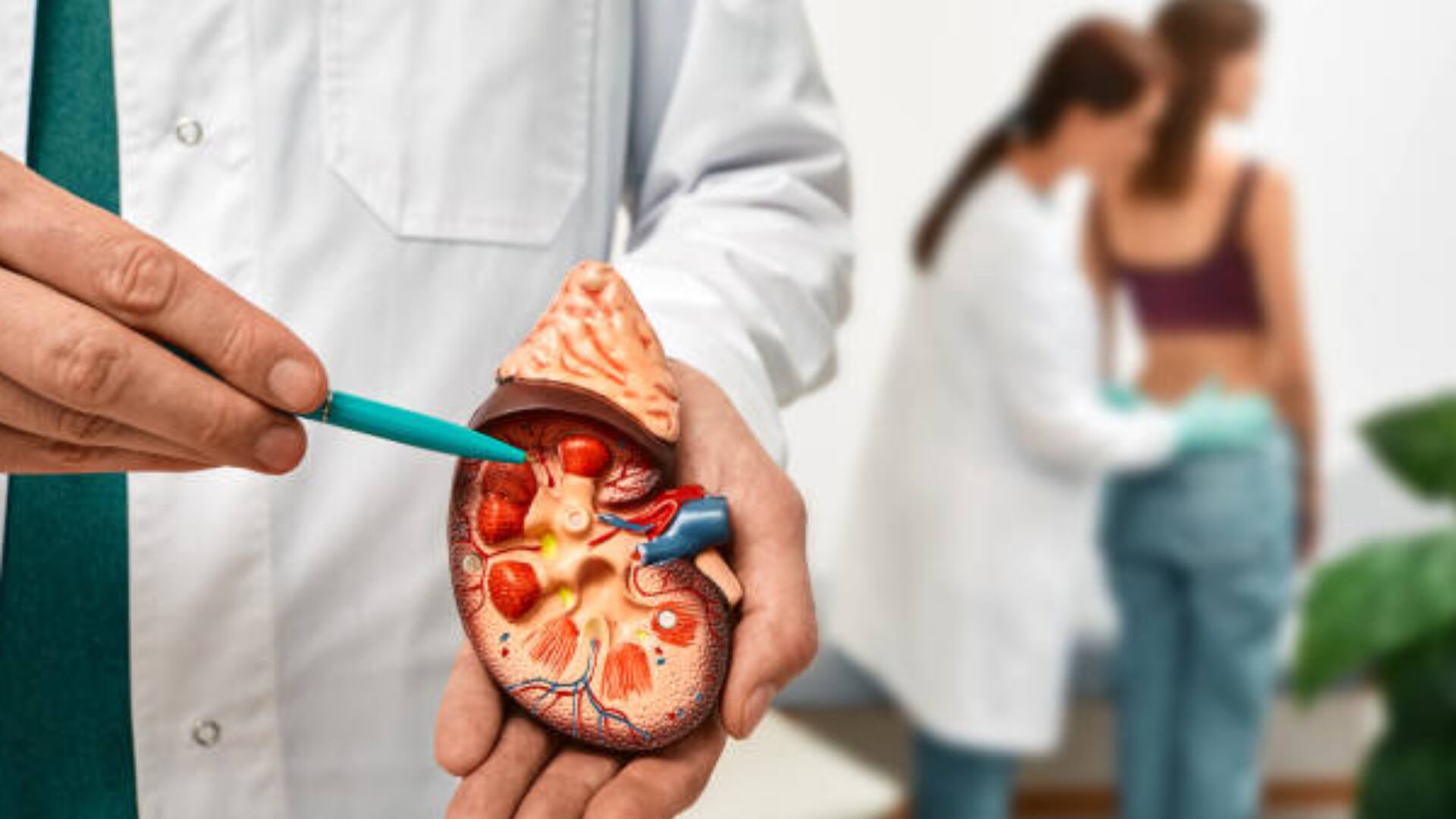 La hidratación adecuada reduce el riesgo de cálculos renales y se recomienda beber entre 2,5 y tres litros al día, con al menos la mitad en agua (iStock)
