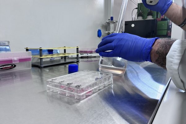 Impulsan un programa clínico para el desarrollo de terapias CAR-T para cáncer de sangre y enfermedades autoinmunes
