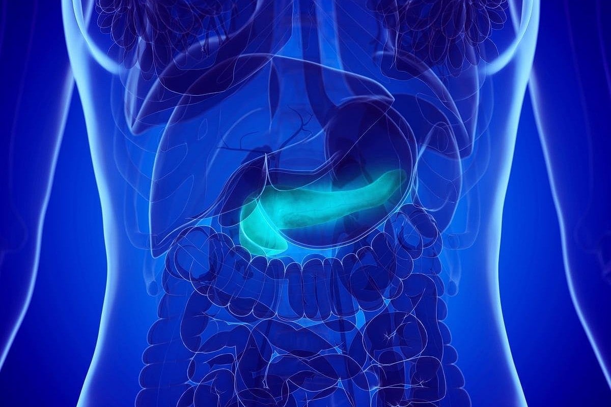 ¿Podría una vacuna prevenir el cáncer de páncreas en personas con alto riesgo?