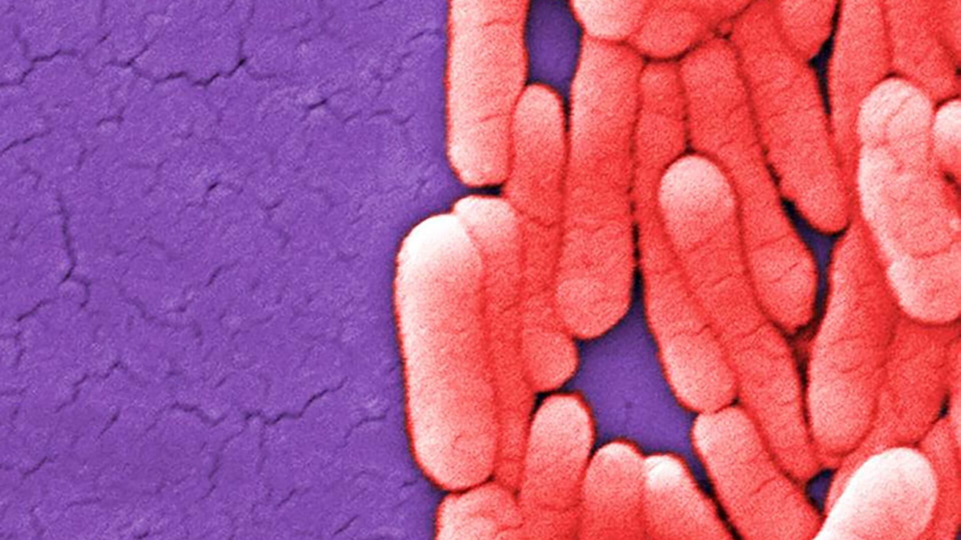 
Los reportes de vigilancia sanitaria describen un brote asociado a fideos instantáneos en catorce países; ya hubo decenas de ingresos hospitalarios (U.S. Centers for Disease Control and Prevention)