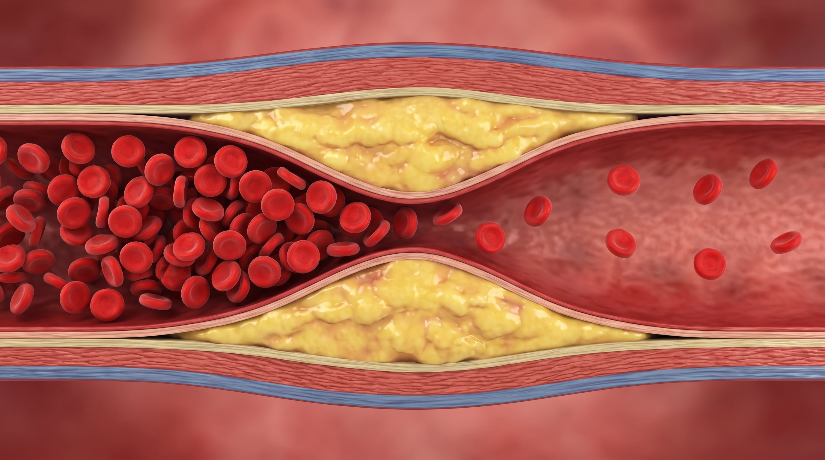 La detección temprana de daño arterial puede ser clave para prevenir enfermedades crónicas en la adultez (Imagen Ilustrativa Infobae)
