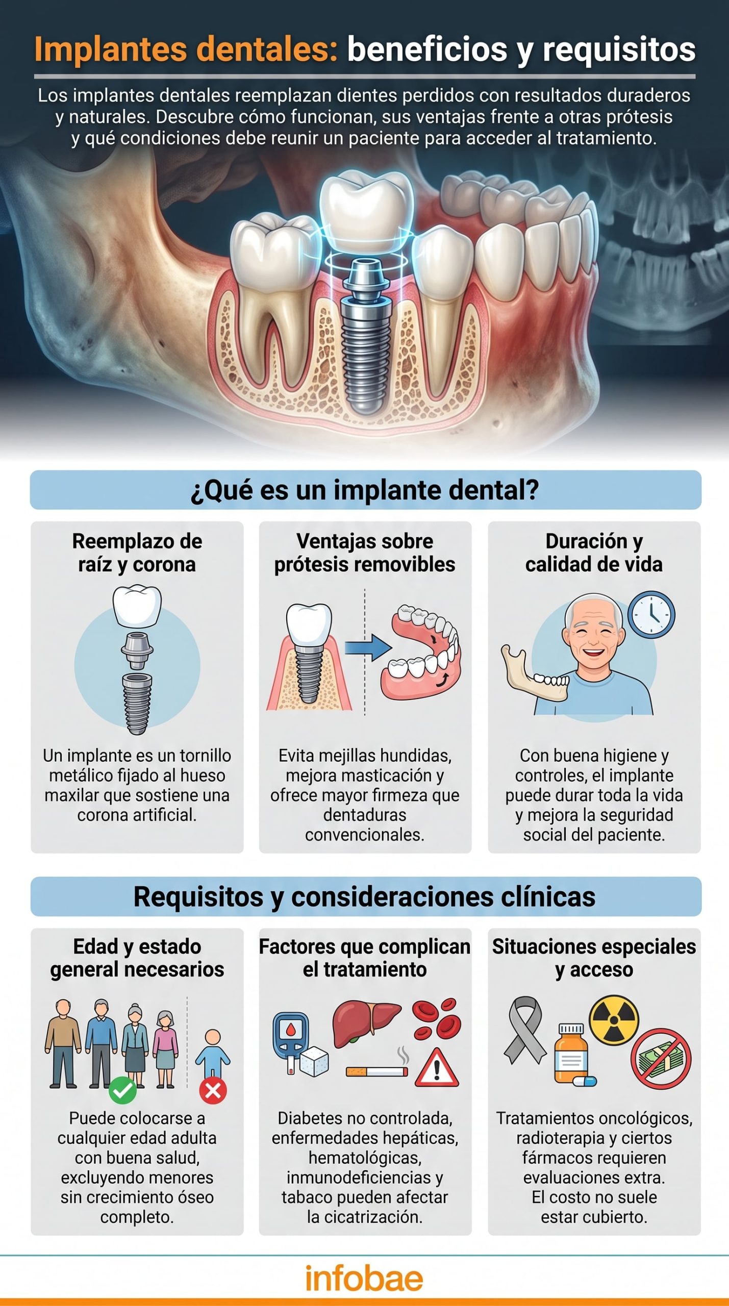 Implantes dentales: cómo funciona la técnica que evita el hundimiento facial y los problemas para masticar