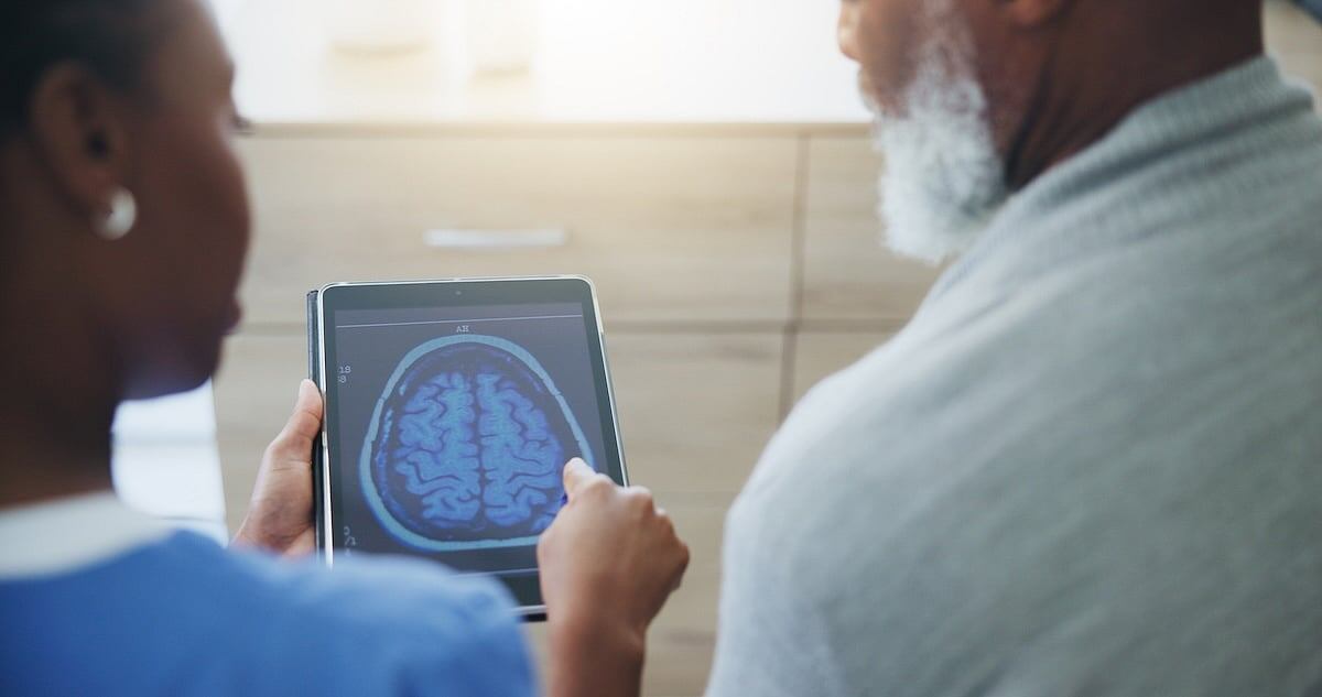 Resultados alentadores con medicamento para el Alzheimer, según un estudio