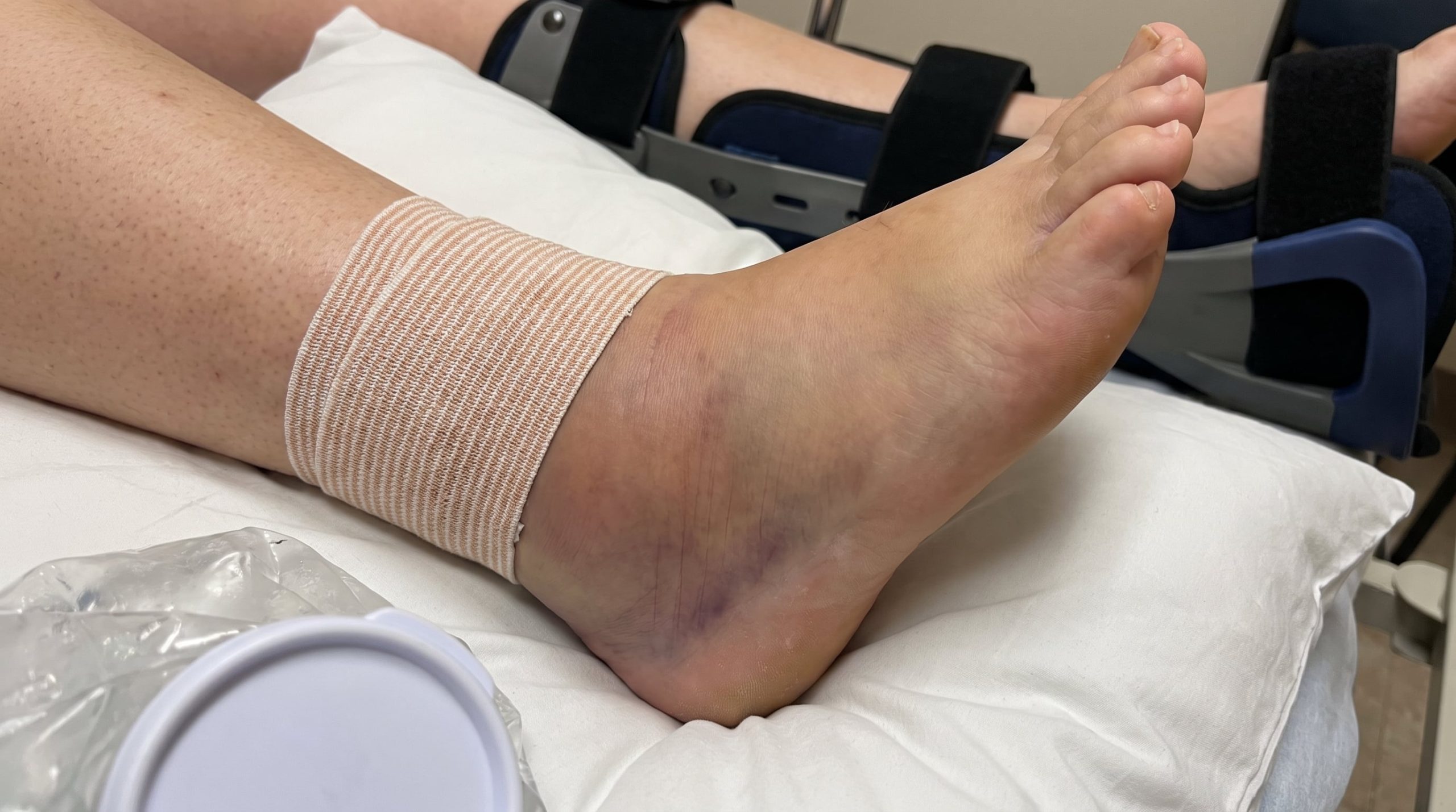Dolor articular, cómo saber si es artritis o una lesión deportiva