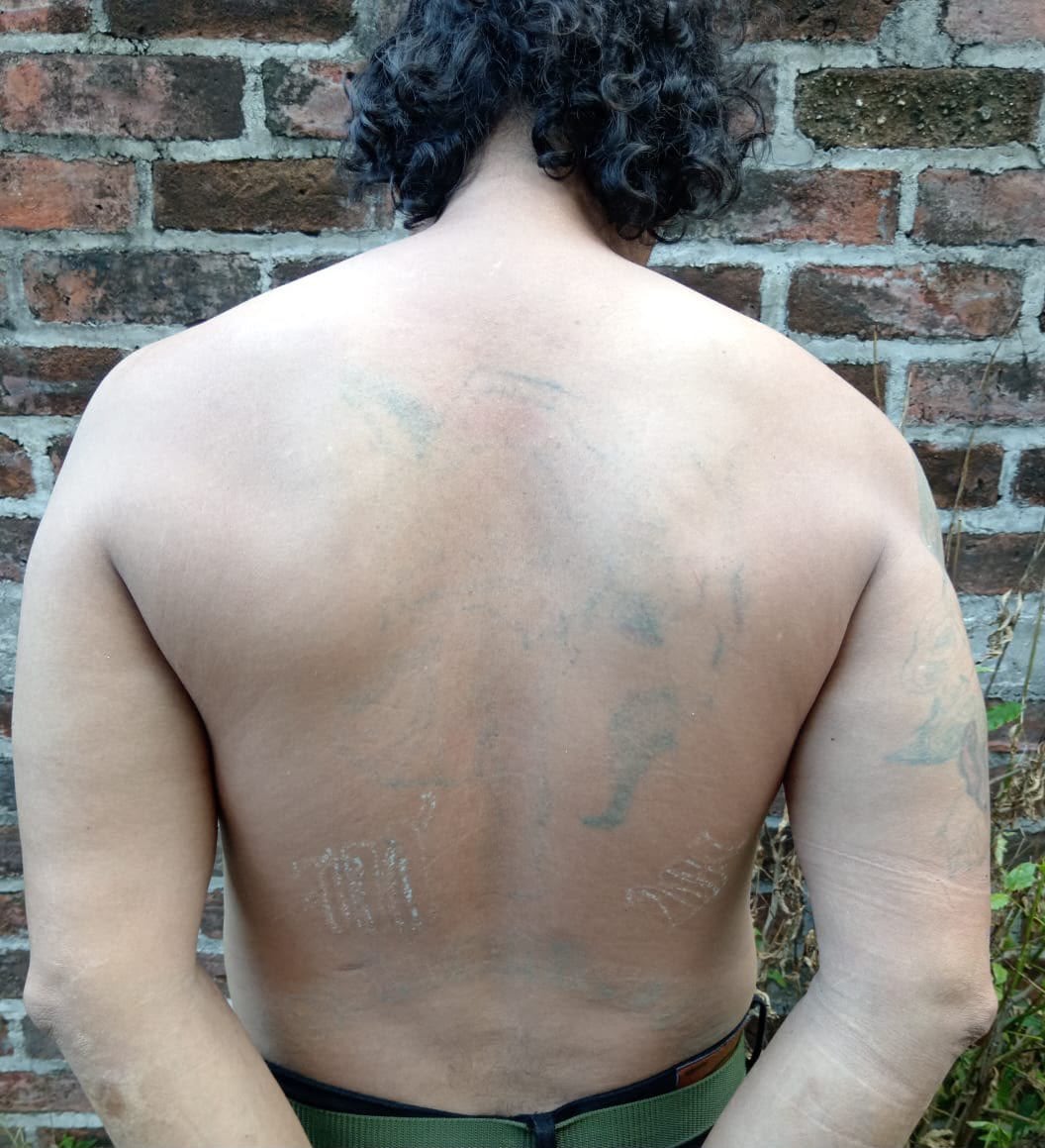 Fuerza Armada capturó a dos “homeboys” de la MS-13 que borraron sus tatuajes para evitar controles en El Salvador