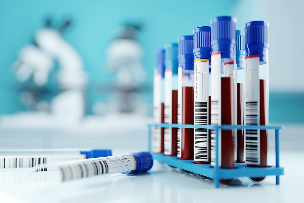 Panel de la FDA respalda con poco margen la prueba de sangre para cáncer a pesar de dudas sobre su eficacia