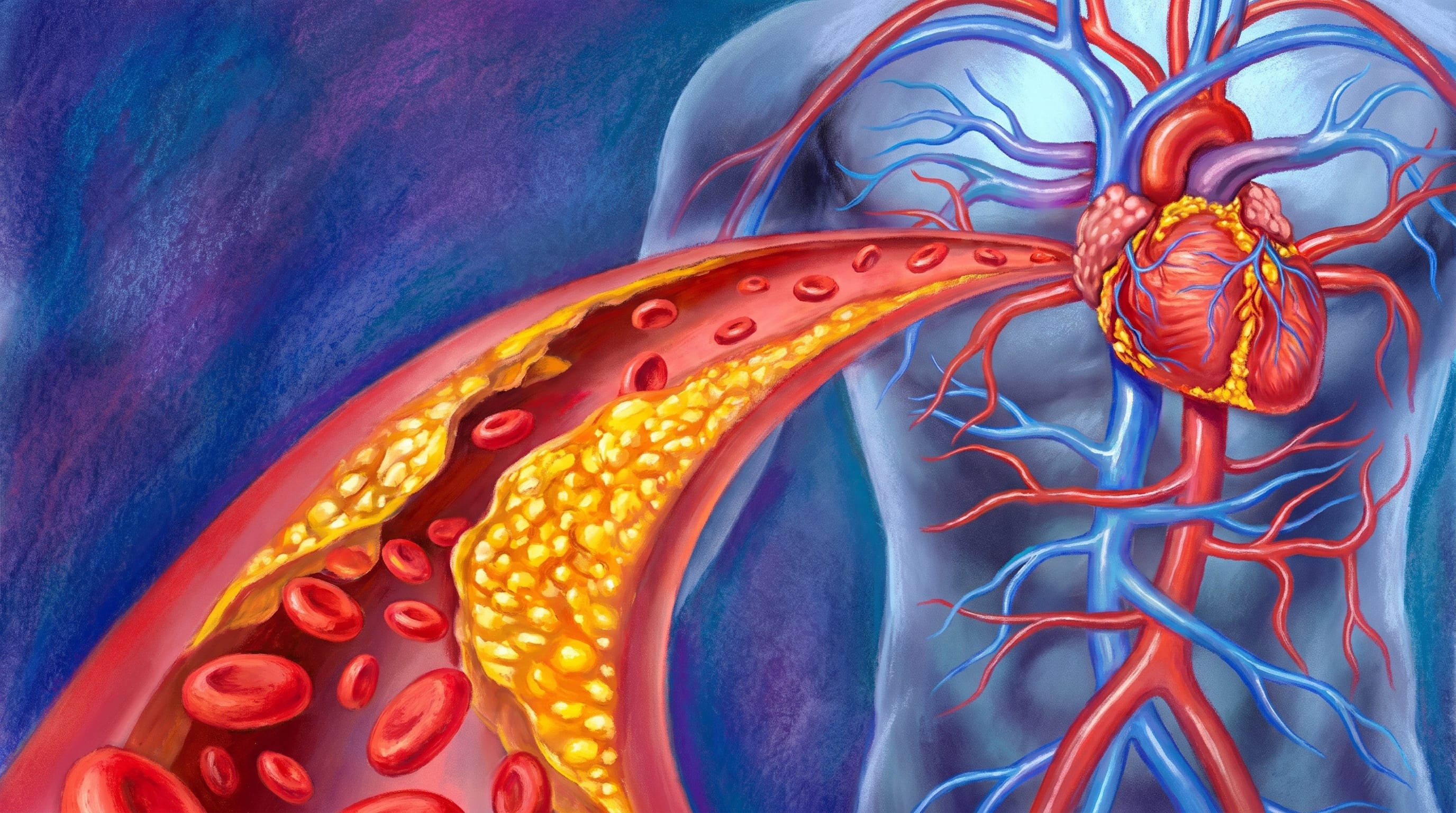 Los análisis genéticos detectaron variantes asociadas tanto con patrones del bazo como con la enfermedad de las arterias coronarias (Imagen Ilustrativa Infobae)