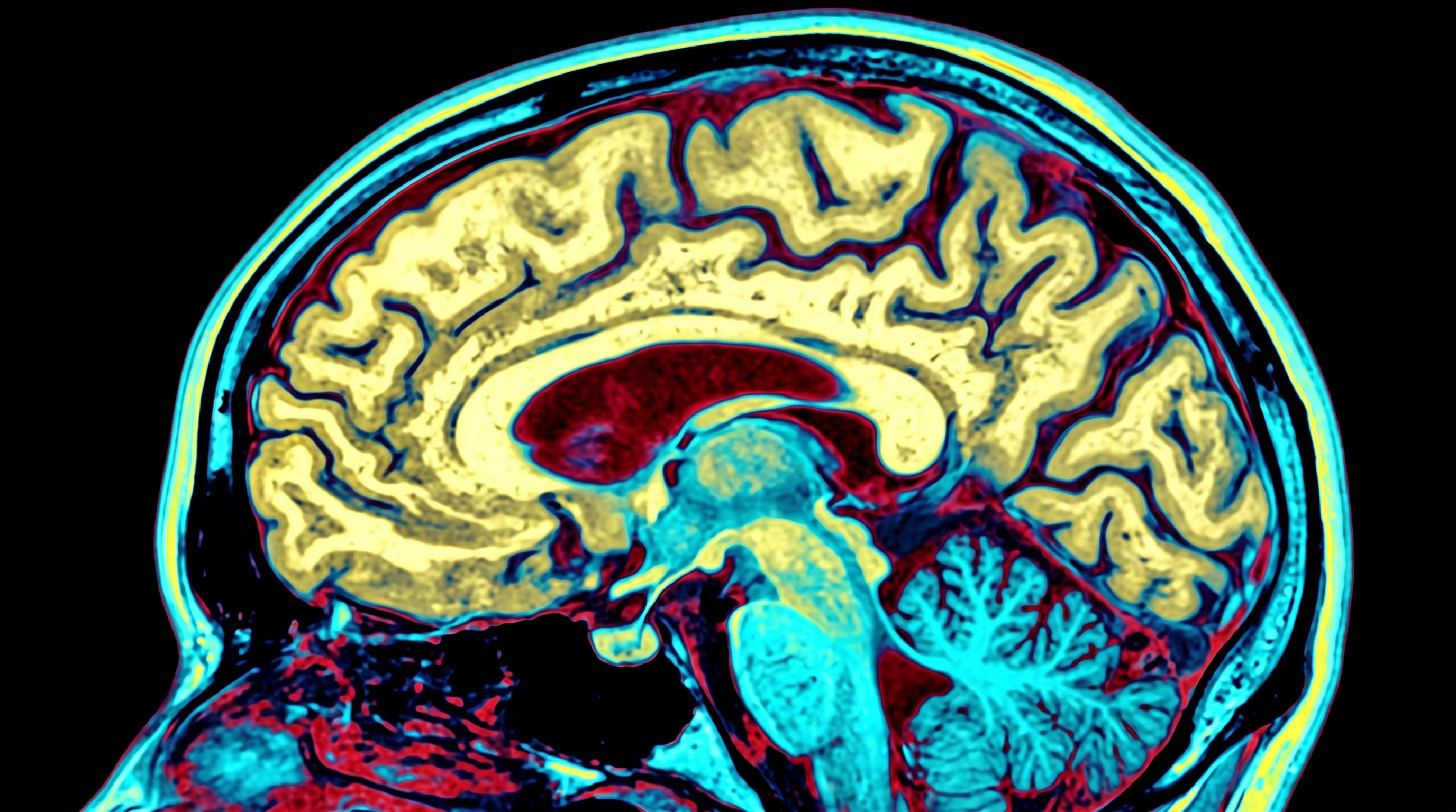 El microorganismo ingresa al cuerpo humano por la mucosa nasal tras la inmersión de la cabeza y avanza hacia el cerebro a través del nervio olfatorio. (Imagen Ilustrativa Infobae)
