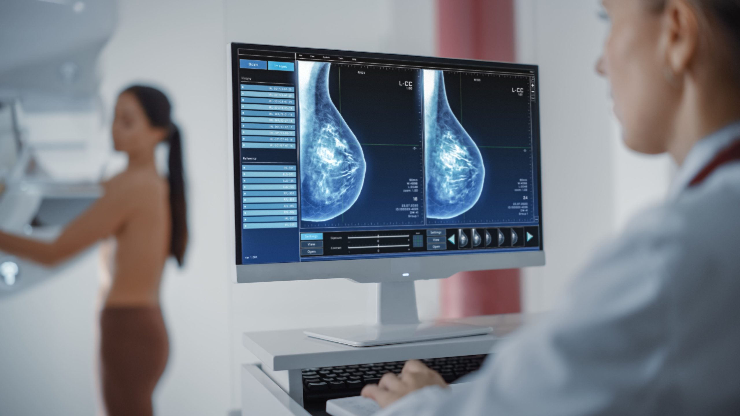 Cáncer de mama en El Salvador: la fragmentación del sistema que dificulta medir y atender la enfermedad, advierte especialista