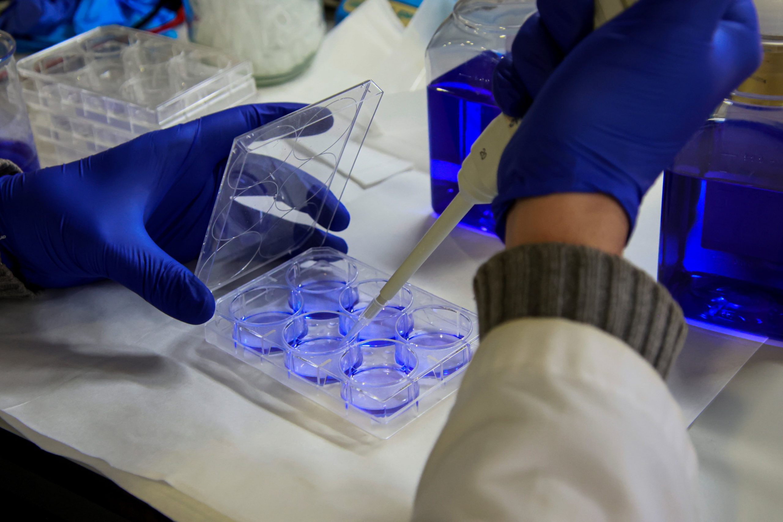 Un estudio reveló por qué un fármaco usado para tratar la hipertensión puede activar la grasa parda y mejorar el metabolismo