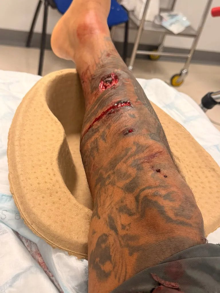 El ex futbolista sufrió el ataque de un perro 